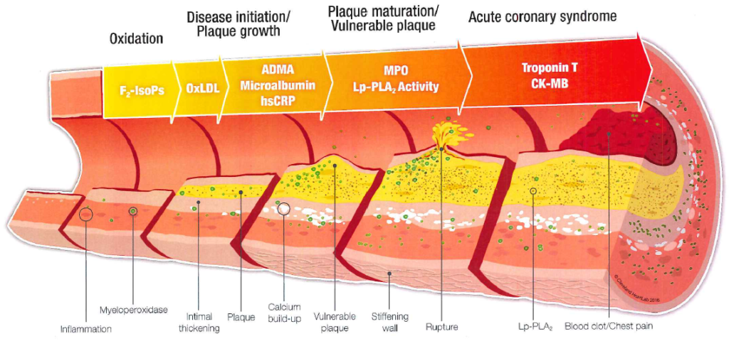 artery wall plaque cardiology functional medicine