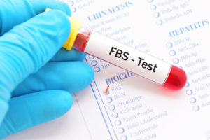 Functional Medicine fasting blood sugar control labs