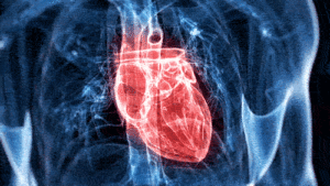 functional medicine tulsa cardiovascular disease heart attack